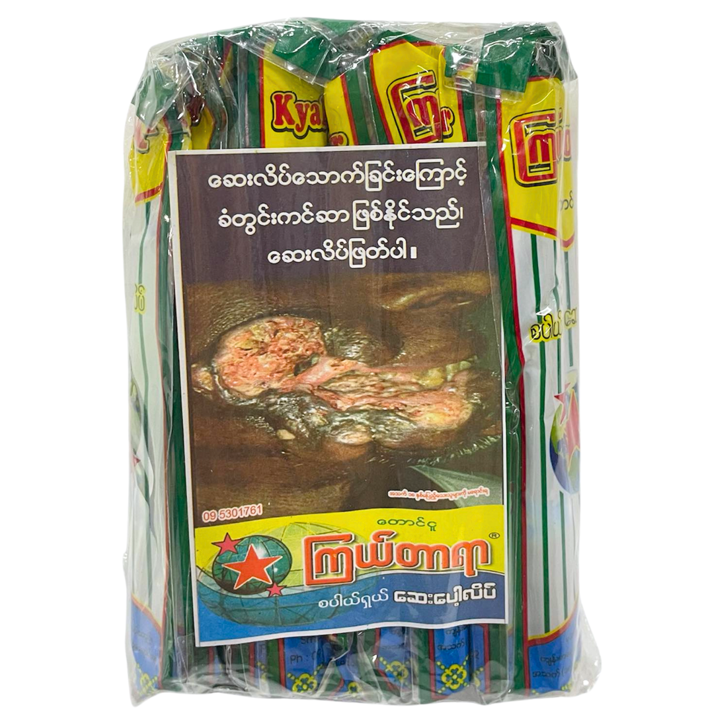 ကြယ်တာရာ ဆေးပေါ့လိပ်|Kyal Thar Yar